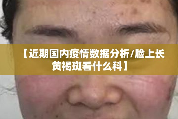 【近期国内疫情数据分析/脸上长黄褐斑看什么科】 【近期国内疫情数据分析/脸上长黄褐斑看什么科】
