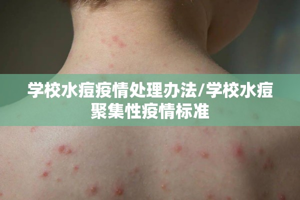 学校水痘疫情处理办法/学校水痘聚集性疫情标准
